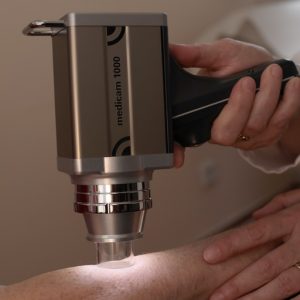 Dermatologie-Tempelhof-Berlin-Hautkrebsvorsorge