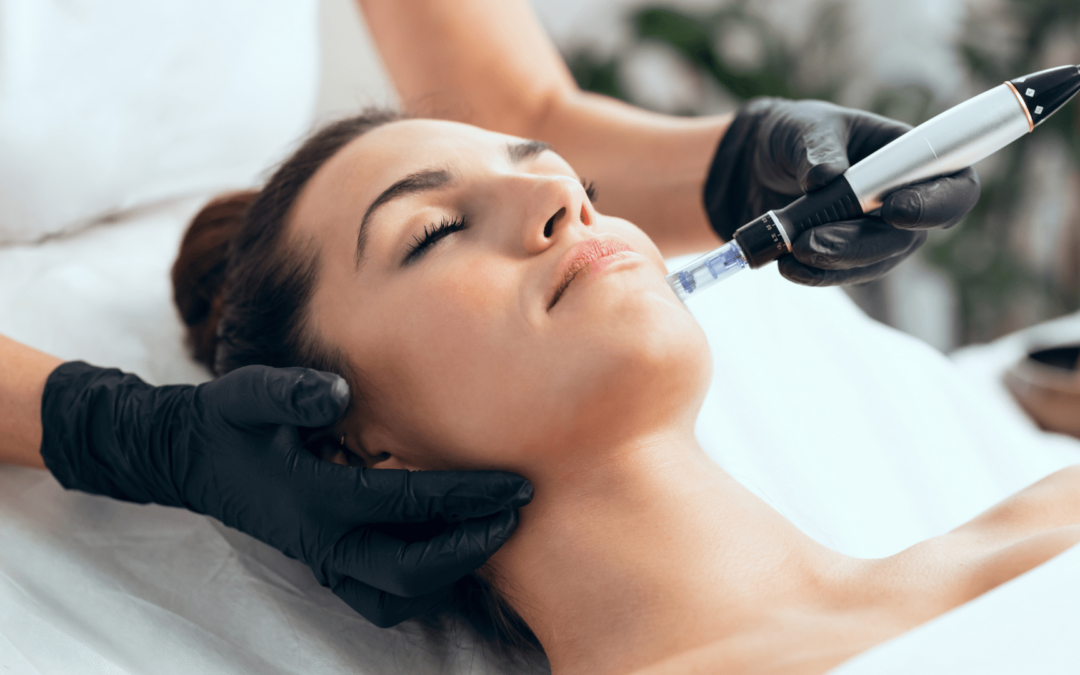 Microneedling: Ein innovativer Ansatz für strahlende Haut. Dermatologie Tempelhof.