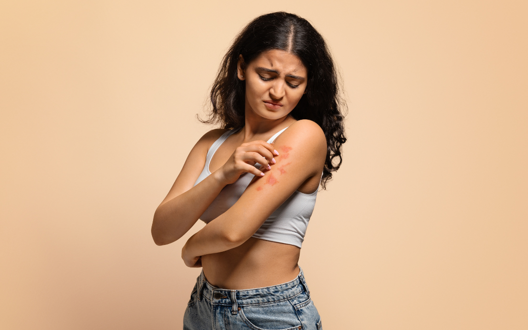 Psoriasis (Schuppenflechte): Ursachen, Symptome und moderne Behandlungsmöglichkeiten