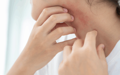 Hautbarriere stärken: Ursachen für Schäden und dermatologisch wirksame Lösungen